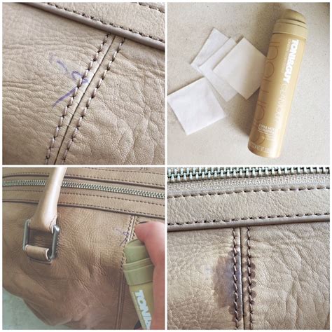 removing pen marks from leather bags.